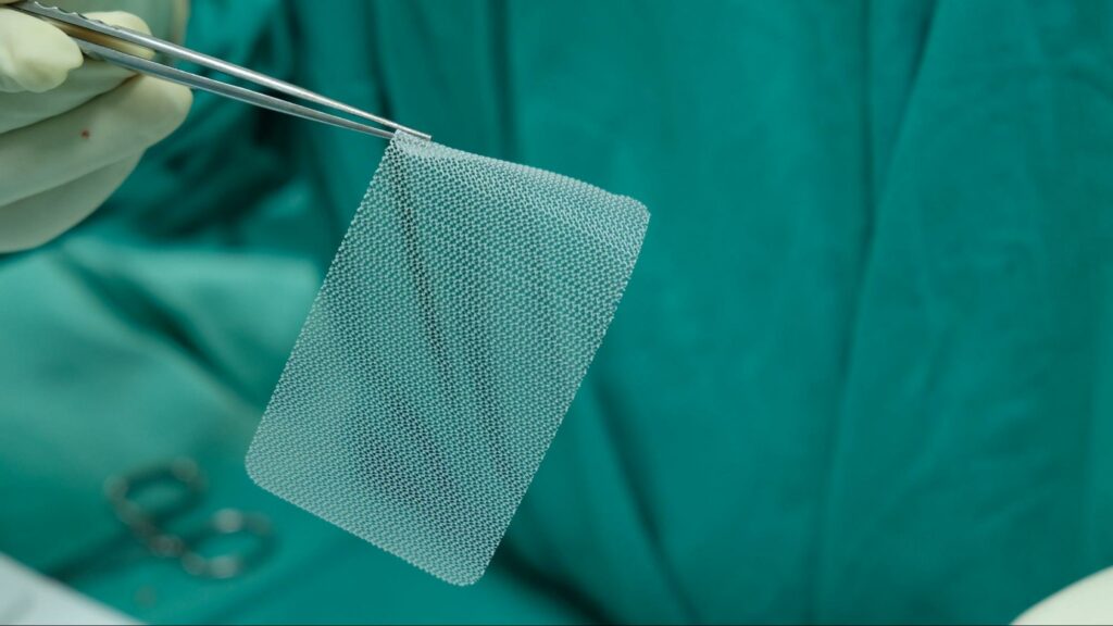 Synthetic Mesh for Inguinal Hernia Repair