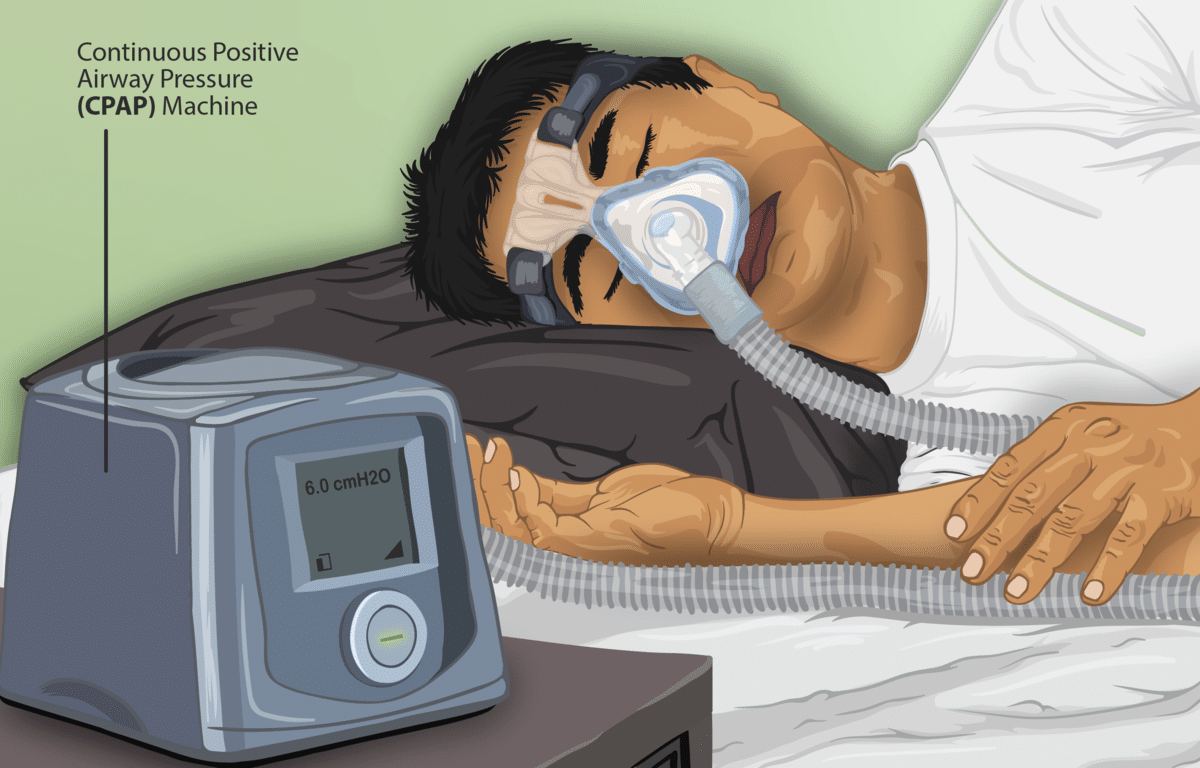 illustration of a CPAP device